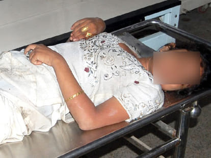 Newly married woman tried to burn alive