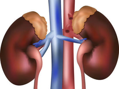 low cost treatment of kidney stone
