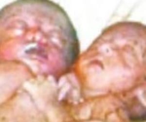 special child born in baharaich