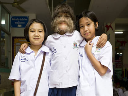 the world's hairiest girl