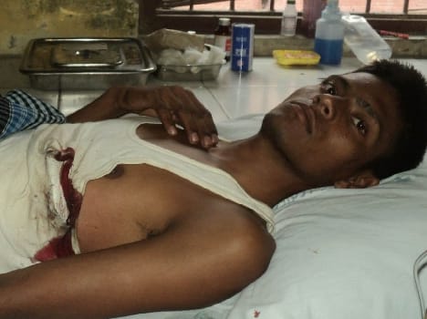 In Pandri assault , firing , four injured
