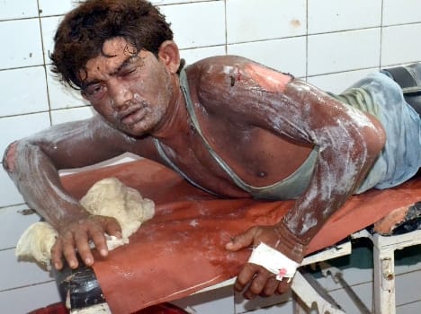 The fire at the factory of sweet cylinder , two People Scorched