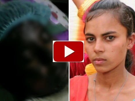 after molestation class 10th student burn alive, truth of self Immolation