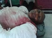 Electoral feuds often two sides Moved bullets, two injured