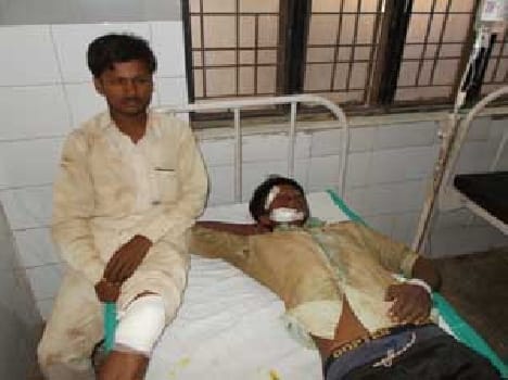 There are shuttering fell three workers injured