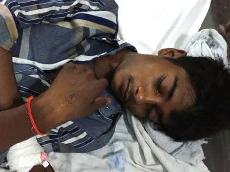 Suspected fever spread in Kanpur, 3 killed and more than 1,000 serious