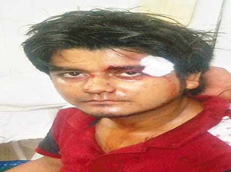 Again firing in kalyanpur, two students injured