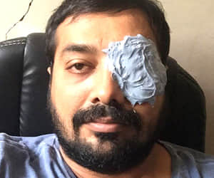 Anurag Kashyap injured