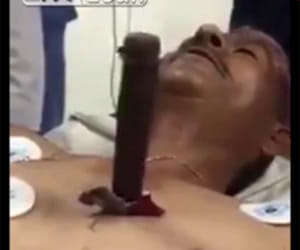 stabbing victim talks to doctors with enormous knife buried