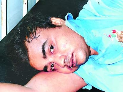 accident of volvo bus coming delhi to lucknow