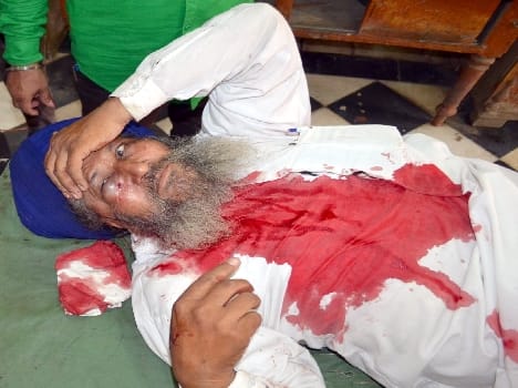 During the test firing range officer and two injured