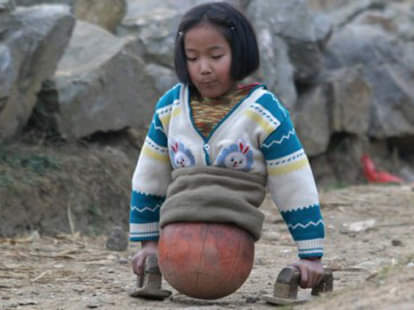 The Inspirational Story of the Legless Basketball Girl