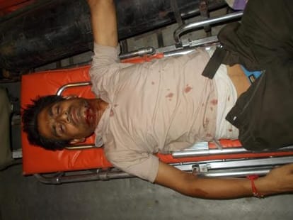 people injured in an bus accident in itainja.