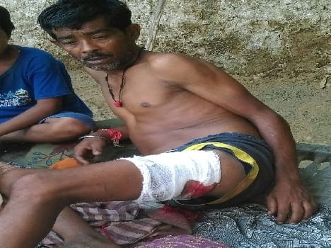 Rural wounded crocodile attack
