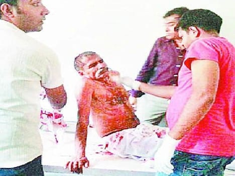 Uncle and nephew shot in baghpat
