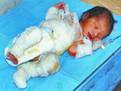 hospital nursery episode in meerut