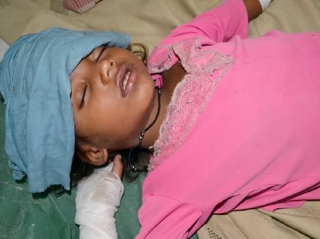Six children suffering fever and recruitment