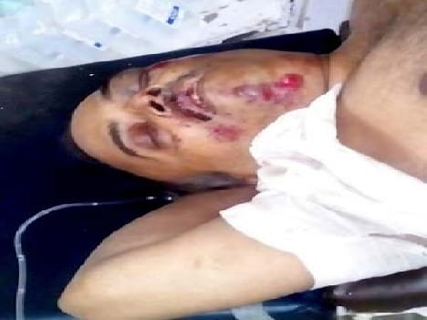 Scotty dumper couple of riders thrashed wife's death