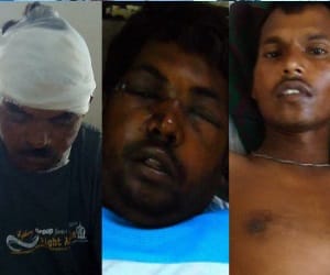 jhabua blast: The injured are not getting treatment