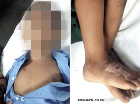 five year-old abused at madrasa by teen