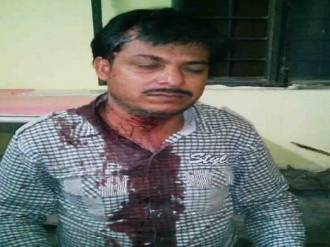 Sarraf robbed and injured in Ujani Badaun