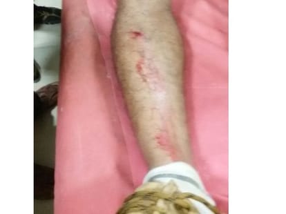 mopster beats nagar nigam officer