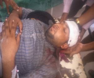 Firing in sanghipur village in haridwar, two man injured.