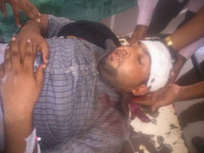 Firing in sanghipur village in haridwar, two man injured.