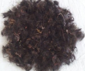 OMG! 4 kg of tuft of hair in child stomach