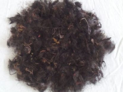 OMG! 4 kg of tuft of hair in child stomach