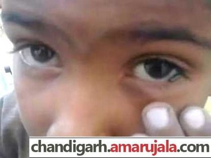 see video, pencil led coming out from child eye