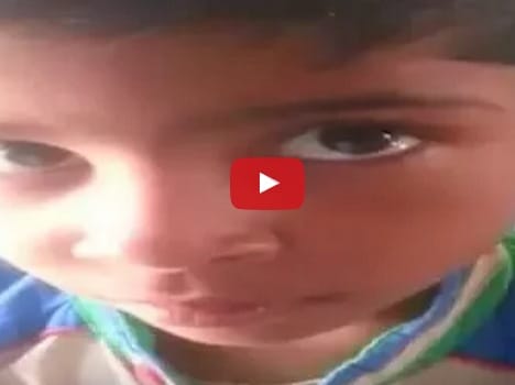 see video, pencil led coming out from child eye