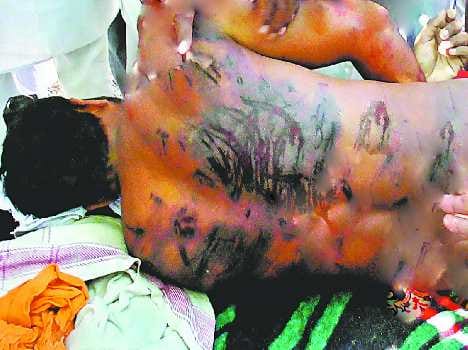 young boy fired with hot tongs by tantric, dead