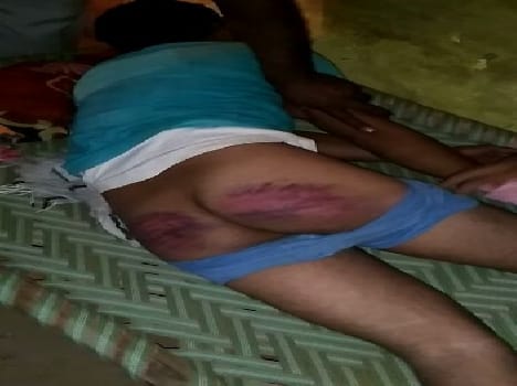 BDC candidate tortured by police