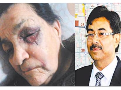 accident of former army officer wife with  IAS's Vehicle dispute