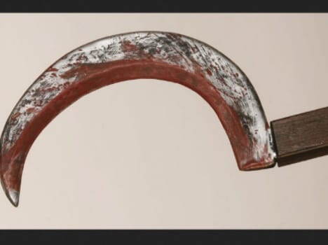 after molestation man attacks with sickle.