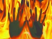 The couple lives in a fire while cooking