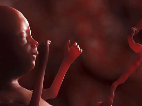 Fetal meet sensation