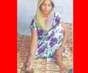 doctors ill treatment result in cutting hand of woman