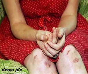 young man entered in house and cut her nose