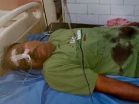 Burglars soldier shot distressing condition