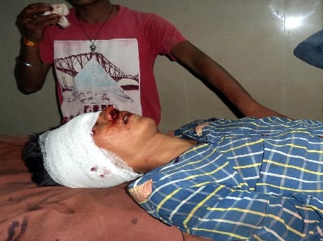 Bike and bicycle collision, five injured