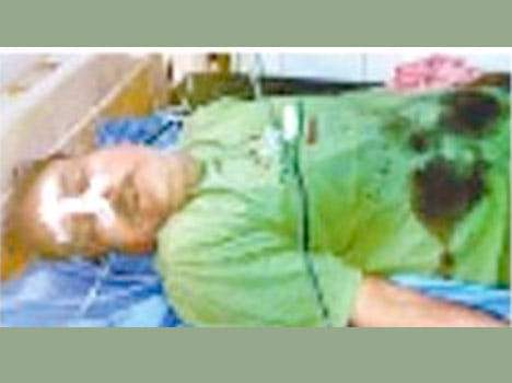 theif fires on police constable in bhadohi up