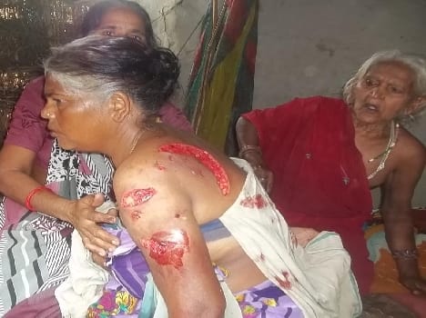Tiger attack Woman injured