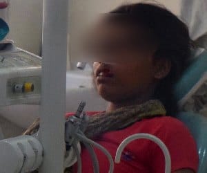 molestation with school girl, accused broke teeth after opposed 