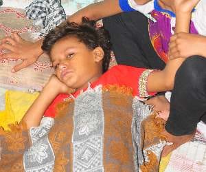 dog bites girl in lucknow