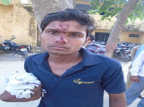 The injured young man in love with firing