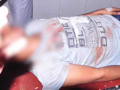 attempt to suicide by couple due to delay in marriage