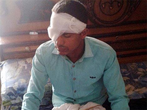 bomb blast in tiffin box