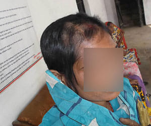 Reports of rape on the woman beaten for not withdrawing